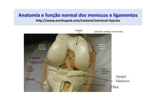 Anatomia e função normal dos meniscos e ligamentos
http://www.eorthopod.com/content/meniscal-injuries
 