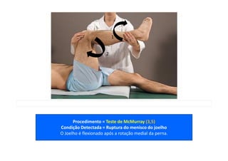 Procedimento = Teste de McMurray (3,5)
Condição Detectada = Ruptura do menisco do joelho
O Joelho é flexionado após a rotação medial da perna.
1
2
 
