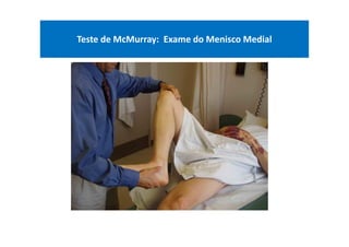 Teste de McMurray: Exame do Menisco Medial
 