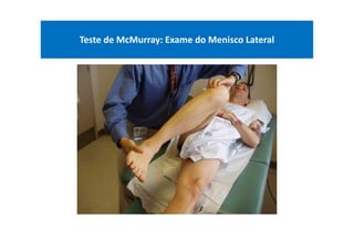 Teste de McMurray: Exame do Menisco Lateral
 