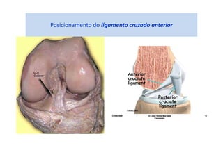 Posicionamento do ligamento cruzado anterior
 