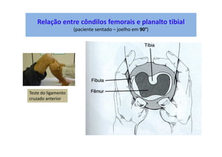 Relação entre côndilos femorais e planalto tibial
(paciente sentado – joelho em 90°)
Teste do ligamento
cruzado anterior
 