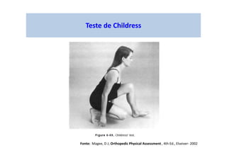 Teste de Childress
Fonte: Magee, D J; Orthopedic Physical Assessment , 4th Ed., Elseiver- 2002
 