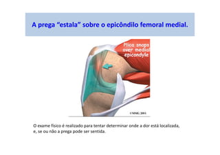 A prega “estala” sobre o epicôndilo femoral medial.
O exame físico é realizado para tentar determinar onde a dor está localizada,
e, se ou não a prega pode ser sentida.
 