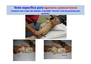 Teste específico para ligamento colateral lateral
Compare com o lado não afetado. A lassidão “normal” varia de paciente para
paciente.
 