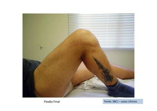 Fonte: SBCJ – casos clínicosFlexão Final
 