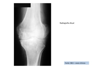 Fonte: SBCJ – casos clínicos
Radiografia Atual
 