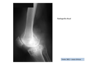 Fonte: SBCJ – casos clínicos
Radiografia Atual
 