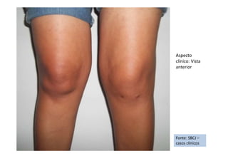 Fonte: SBCJ –
casos clínicos
Aspecto
clínico: Vista
anterior
 