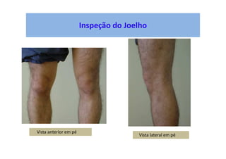Inspeção do Joelho
Vista anterior em pé
Vista lateral em pé
 