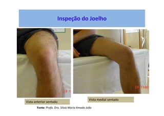 Inspeção do Joelho
Vista anterior sentado
Vista medial sentado
Fonte: Profa. Dra. Sílvia Maria Amado João
 