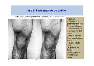 A e B Face anterior do joelho
A, patela;
B, tendão do m.
quadríceps femoral;
C, m. vasto lateral;
D, m. vasto medial;
E, m. vasto medial
oblíquo;
F, tendão patelar;
G, corpo adiposo de
Hoffa;
H, tuberosidade
tibial;
I, tubérculo de
Gerdy;
J, pata de ganso;
K, platô tibial
medial.
Fonte: Magee, D J; Orthopedic Physical Assessment , 4th Ed., Elseiver- 2002
 