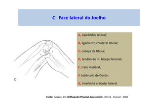 C Face lateral do Joelho
A, epicôndilo lateral;
B, ligamento colateral lateral;
C, cabeça da fíbula;
D, tendão do m. bíceps femoral;
E, trato iliotibial;
F, tubérculo de Gerdy;
G, interlinha articular lateral.
Fonte: Magee, D J; Orthopedic Physical Assessment , 4th Ed., Elseiver- 2002
 