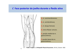 C Face posterior do joelho durante a flexão ativa
A, m. semimembranoso;
B, m. semitendinoso;
C, m. bíceps femoral;
D, nervo fibular comum;
E, porção medial do m.
gastrocnêmico;
F, porção lateral do m.
gastrocnêmico.
Fonte: Magee, D J; Orthopedic Physical Assessment , 4th Ed., Elseiver- 2002
 