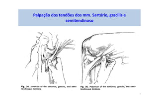Palpação dos tendões dos mm. Sartório, gracilis e
semitendinoso
 