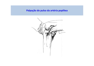 Palpação do pulso da artéria poplítea
 