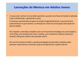 • A causa mais comum é uma lesão esportiva, quando uma força de torção é aplicada
à perna flexionada, suportando o peso.
O mesnisco aprisionado em geral se divide longitudinalmente e sua borda livre
pode deslocar-se para dentro, na direção do centro da articulação (laceração em
alça de balde).
Isto impede a extensão completa (com um travamento fisiológico da articulação) e,
se for feita uma tentativa de sticar o joelho, uma resistência elástica dolorosa é
sentida (“bloqueio elástico da extensão total”).
No caso de menisco medial, a perda prolongada da extensão completa pode
provocar estiramento e eventual ruptura do ligamento cruzado anterior.
Lacerações do Menisco em Adultos Jovens
 