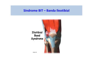 Síndrome BIT – Banda Ileotibial
 