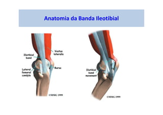 Anatomia da Banda Ileotibial
 