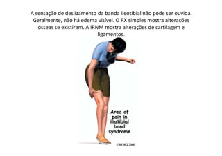 A sensação de deslizamento da banda ileotibial não pode ser ouvida.
Geralmente, não há edema visível. O RX simples mostra alterações
ósseas se existirem. A IRNM mostra alterações de cartilagem e
ligamentos.
 