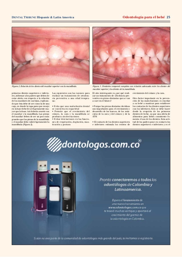 Odontologia Para Bebes
