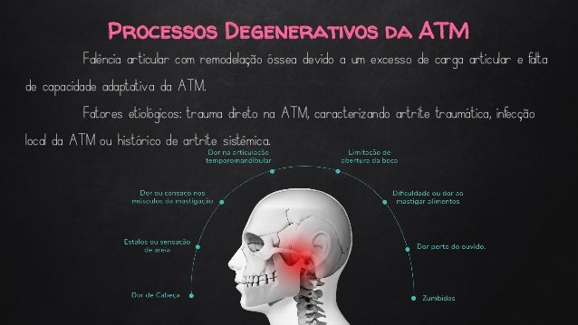 disfuncao temporomandibular dtm