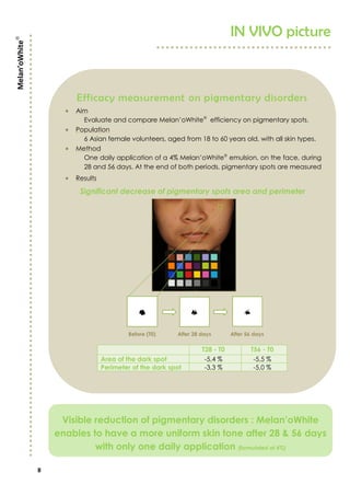 8
IN VIVO picture
Melan’oWhite
Efficacy measurement on pigmentary disorders
 Aim
Evaluate and compare Melan’oWhite
efficiency on pigmentary spots.
 Population
6 Asian female volunteers, aged from 18 to 60 years old, with all skin types.
 Method
One daily application of a 4% Melan’oWhite
emulsion, on the face, during
28 and 56 days. At the end of both periods, pigmentary spots are measured
 Results
Significant decrease of pigmentary spots area and perimeter
Before (T0) After 28 days After 56 days
T28 - T0 T56 - T0
Area of the dark spot -5,4 % -5,5 %
Perimeter of the dark spot -3,3 % -5,0 %
Visible reduction of pigmentary disorders : Melan’oWhite
enables to have a more uniform skin tone after 28 & 56 days
with only one daily application (formulated at 4%)
 