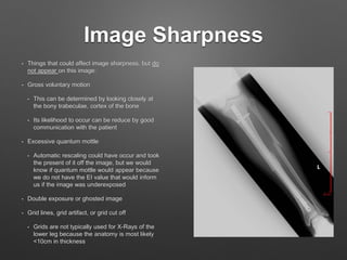 D torres lower_leg_oralppt3 | PPTX