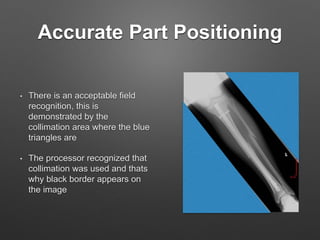 D torres lower_leg_oralppt3 | PPTX