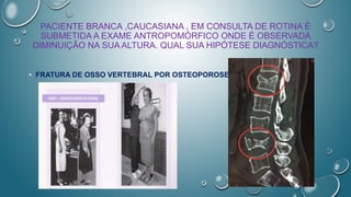 PACIENTE BRANCA ,CAUCASIANA , EM CONSULTA DE ROTINA É
SUBMETIDA A EXAME ANTROPOMÓRFICO ONDE É OBSERVADA
DIMINUIÇÃO NA SUA ALTURA. QUAL SUA HIPÓTESE DIAGNÓSTICA?
• FRATURA DE OSSO VERTEBRAL POR OSTEOPOROSE
 