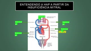 ENTENDENDO A HAP A PARTIR DA
INSUFICIÊNCIA MITRAL
Ins.Mitral
Sobrecar
ga
Sobrecar
ga
Sobrecar
ga
Sobrecar
ga
Sobrecar
ga
 