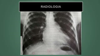 RADIOLOGIA
 