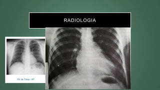 RADIOLOGIA
 