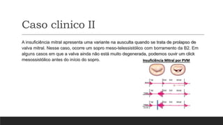 Caso clinico II
A insuficiência mitral apresenta uma variante na ausculta quando se trata de prolapso de
valva mitral. Nesse caso, ocorre um sopro meso-telessistólico com borramento da B2. Em
alguns casos em que a valva ainda não está muito degenerada, podemos ouvir um click
mesossistólico antes do início do sopro.
 