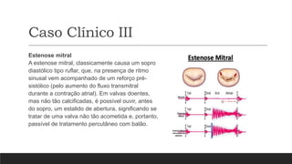Caso Clínico III
Estenose mitral
A estenose mitral, classicamente causa um sopro
diastólico tipo ruflar, que, na presença de ritmo
sinusal vem acompanhado de um reforço pré-
sistólico (pelo aumento do fluxo transmitral
durante a contração atrial). Em valvas doentes,
mas não tão calcificadas, é possível ouvir, antes
do sopro, um estalido de abertura, significando se
tratar de uma valva não tão acometida e, portanto,
passível de tratamento percutâneo com balão.
 