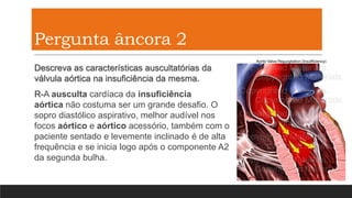 Pergunta âncora 2
Descreva as características auscultatórias da
válvula aórtica na insuficiência da mesma.
R-A ausculta cardíaca da insuficiência
aórtica não costuma ser um grande desafio. O
sopro diastólico aspirativo, melhor audível nos
focos aórtico e aórtico acessório, também com o
paciente sentado e levemente inclinado é de alta
frequência e se inicia logo após o componente A2
da segunda bulha.
 