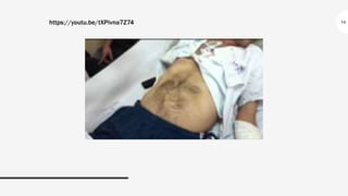 14
https://youtu.be/tXPivna7Z74
 