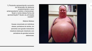 1) Paciente apresentando aumento
da dimensão do abdome
predominando o eixo
anteroposterior sobre o transversal.
Qual o nome dessa forma de
apresentação? Quais as principais
causas?
Abdome Globoso
Causas: encontrado em indivíduos
obesos, portadores de ascites, em
pacientes com grande meteorismo
intestinal (obstrução intestinal) e em
portadores de grandes tumores
abdominais.
6
 