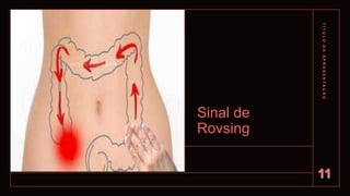 Sinal de
Rovsing
T
Í
T
U
L
O
D
A
A
P
R
E
S
E
N
T
A
Ç
Ã
O
11
 