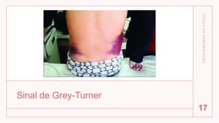 Sinal de Grey-Turner
T
Í
T
U
L
O
D
A
A
P
R
E
S
E
N
T
A
Ç
Ã
O
17
 