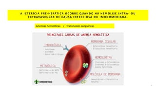 A I C T E R Í C I A P R É - H E PÁT I C A O C O R R E Q UA N D O H Á H E M Ó L I S E I N T R A - O U
E X T R AVA S C U L A R D E C AU S A I N F E C C I O S A O U I M U N O M E D I A DA .
4
Anemias hemolíticas / Transfusões sanguíneas
 