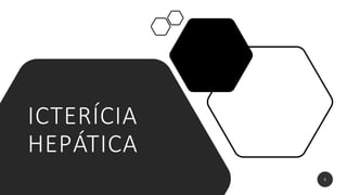 ICTERÍCIA
HEPÁTICA
5
 
