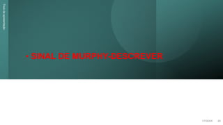 • SINAL DE MURPHY-DESCREVER
Título
da
apresentação
1/7/20XX 20
 