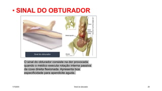 • SINAL DO OBTURADOR
1/7/20XX Sinal do obturador 25
O sinal do obturador consiste na dor provocada
quando o médico executa rotação interna passiva
da coxa direita flexionada. Apresenta boa
especificidade para apendicite aguda.
 