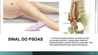 SINAL DO PSOAS
Título
da
apresentação
• O sinal do psoas positivo consiste em dor
provocada quando o examinador estende
passivamente o quadril direito do paciente. Tem
boa especificidade para apendicite aguda.
1/7/20XX 27
 