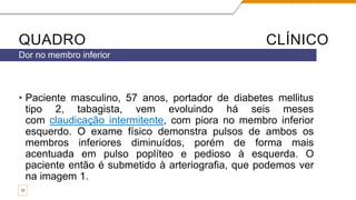 QUADRO CLÍNICO
• Paciente masculino, 57 anos, portador de diabetes mellitus
tipo 2, tabagista, vem evoluindo há seis meses
com claudicação intermitente, com piora no membro inferior
esquerdo. O exame físico demonstra pulsos de ambos os
membros inferiores diminuídos, porém de forma mais
acentuada em pulso poplíteo e pedioso à esquerda. O
paciente então é submetido à arteriografia, que podemos ver
na imagem 1.
Dor no membro inferior
12
 