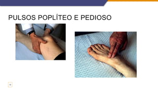 PULSOS POPLÍTEO E PEDIOSO
13
 