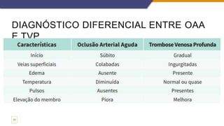 DIAGNÓSTICO DIFERENCIAL ENTRE OAA
E TVP
17
 