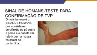 SINAL DE HOMANS-TESTE PARA
CONFIRMAÇÃO DE TVP
O mais famoso é o
SINAL DE HOMANS
que consiste na
dorsiflexão do pé sobre
a perna e o doente vai
referir dor na massa
muscular na
panturrilha.
 