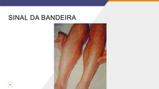 SINAL DA BANDEIRA
27
 